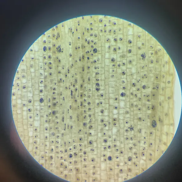 Onion root tip cells in rows, several caught mid-division.