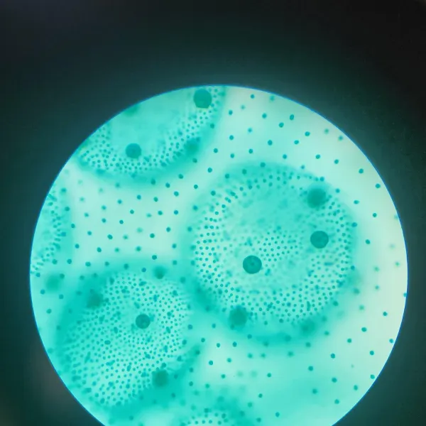 Volvox algae colonies under a microscope, teal-stained spheres dotted with cells.